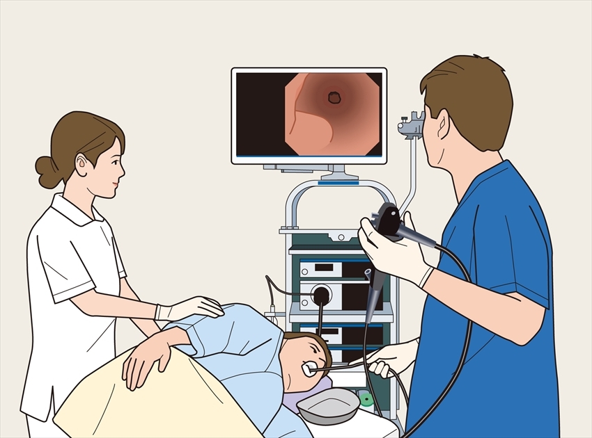 胃内視鏡検査（胃カメラ）検査の流れ